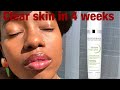 Видео - Bioderma night peel cleared my skin in under 4 weeks.