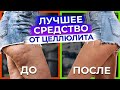 Видео - Как избавиться от ЦЕЛЛЮЛИТА? / Способ РАБОТАЕТ на 100%