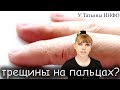 Видео - ТРЕЩИНЫ на РУКАХ или НОГАХ и что с ними делать???