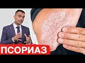 Видео - 2 Лучших Средства Для Лечения Псориаза - Лечение Псориаза | Доктор Вивек Джоши