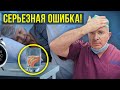 Видео - НЕ ВЗДУМАЙ снимать протез на ночь! Ошибка большинства…