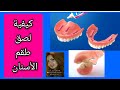 Видео - كيفية لصق طقم الأسنان بالصمغ و الغراء الطبي ( لاصق الطقم )  لتثبيته في الفك د/إيريني