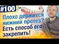 Видео - Закрепить нижний зубной протез на имплантах. Цена? Почему это самый удобный способ крепления?