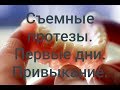 Видео - Съемные протезы. Привыкание.