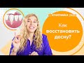 Видео - Опустилась десна — что делать?