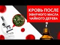 Видео - Кровь после эфирного масла чайного дерева | ИССЛЕДОВАНИЯ МИА #кровьпосле #чайноедерево #ароматерапия