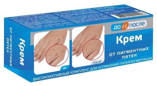 До и После Крем для тела От пигментных пятен - фото 1