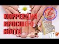 Видео - Вросший ноготь. Уход за ногтями. Что Если Слоятся ногти? НОГТИНОРМ!