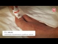 Видео - Процесс удаления ногтя с помощью средства Микостоп