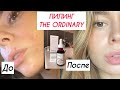 Видео - КРОВАВЫЙ ПИЛИНГ | THE ORDINARY AHA 30% BHA 2% кислоты от постакне