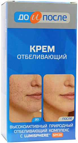 До и После крем отбеливающий для лица - фото 1