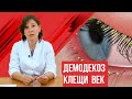 Видео - Демодекоз век, когда нужно лечение и каким оно должно быть?