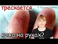 Видео - Почему ТРЕСКАЕТСЯ КОЖА НА РУКАХ и как ЛЕГКО от ЭТОГО ИЗБАВИТЬСЯ?