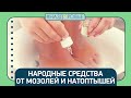 Видео - #НАЗДОРОВЬЕ: народные средства от мозолей