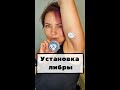 Видео - Установка сенсора FreeStyle Libre