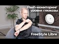 Видео - FreeStyle Libre - система Flash мониторинга глюкозы. Обзор и опыт использования, плюсы, минусы