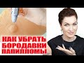 Видео - Нашла крутое средство от бородавок и папиллом за копейки!