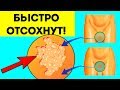 Видео - Папилломы отпадут быстро. Самый простой способ удаления висячих родинок в домашних условиях дёшево