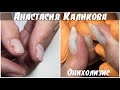 Видео - Сюрприз под гель-лаком/Онихолизис/Лечение от INKI