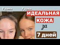 Видео - ЧИСТАЯ КОЖА ЗА 7 ДНЕЙ ~ 5 ПРИВЫЧЕК ДЛЯ ЧИСТОЙ КОЖИ