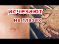 Видео - ДЕШЕВОЕ Сильнодействующее Средство От Пигментных Пятен и Морщин