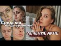 Видео - КАК Я ИЗБАВИЛАСЬ ОТ ПРЫЩЕЙ?? мой план лечения акне и пост-акне ❤️‍🩹 какой уход СЕЙЧАС?🧴