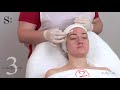 Видео - Jessner peel Health peel (Пилинг Джесснера)