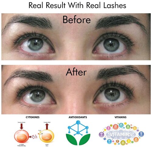 MD Lash Factor средство для роста ресниц - фото 5