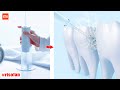 Видео - XIAOMI MIJIA MEO701 Portable Oral Irrigator Dental Teeth Water Flosser.